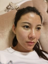 体验后-广州美莱医疗美容医院