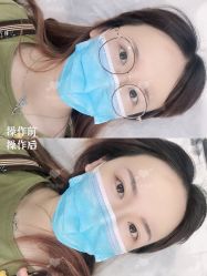 点击看大图 -西施无菌半永久纹绣眉眼影唇轻增发纹发际线
