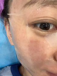 -北京米扬丽格医疗美容·联合丽格鼻整形中心