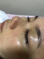 点击看大图 -佛山艺美医疗美容·整形·美肤·塑形