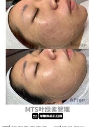 -E.beauty驻颜·痘敏肌调理中心