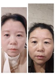 -杭州米兰柏羽医疗美容医院