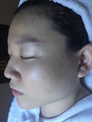-皇族养心堂·净痘·修敏·御颜