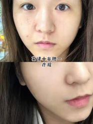 -上海漾颜医疗美容