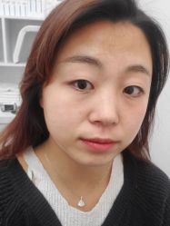 体验后-JS医疗美容