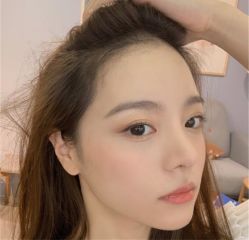 -碧莲盛·不剃发植发