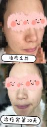 -深圳鹏爱悦心医疗美容医院