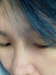 体验后-中加科洋医疗美容
