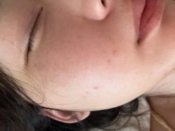 体验后-重庆军科整形美容医院