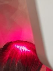 -碧莲盛·不剃发植发