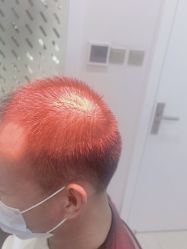 -雍禾植发全国连锁