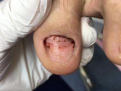 -Andrew指甲专科灰指甲·甲沟炎矫正·3D步态矫形鞋垫定制(浦三路店)