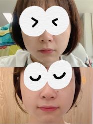 -小颜秘家·韩国整骨
