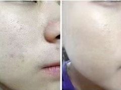 -艾通康缘艾灸.疼痛.睡眠养生馆(凤凰城店)