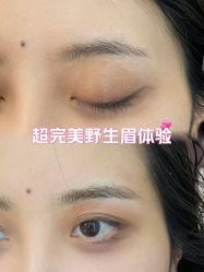 -德绣·机器野生眉发际线·美瞳线半永久