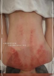 点击看大图 -智丽佳人祛斑祛痘美容美体