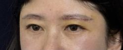 -杭州美莱医疗美容医院