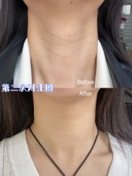 -新美荟医美·专注面部美学抗衰