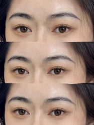 点击看大图 -杨益美学·野生眉半永久纹眉发际线