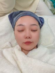 -安那般那皮肤年轻化ANAPANA