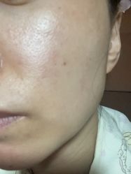 -安徽合肥韩美整形外科医院