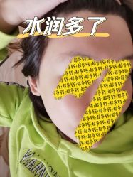体验后-纯粹医美