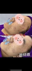-蕾特恩专业祛痘国际连锁
