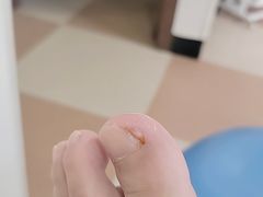 -世龙世家灰指甲鸡眼脚气甲沟炎跖疣护理(通州店)