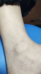 -天道专业洗纹身