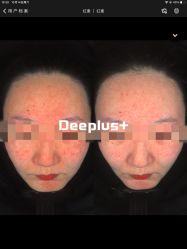 -Deeplus+韩国皮肤管理한국피부관리·C:Lab肌肤实验室