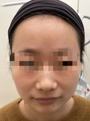 体验前-BR光电保养