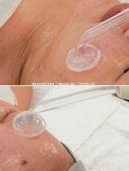 -韩国淼美颜皮肤管理官方直营店