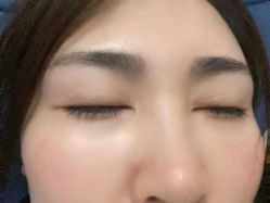 点击看大图 体验后-大连美天医疗美容医院