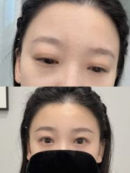 点击看大图 -张小野·专业半永久纹眉