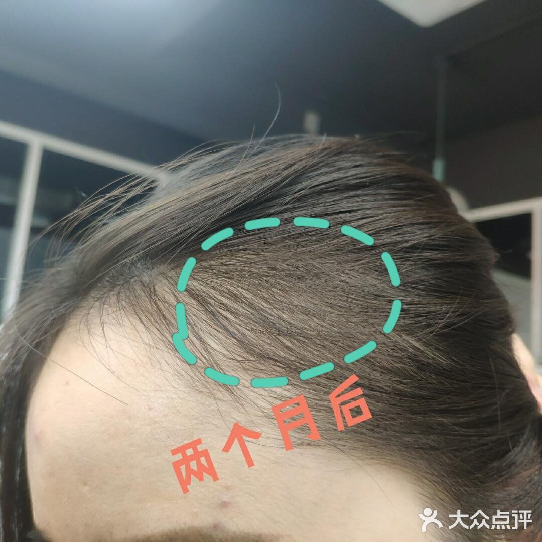 太好用了 谁说生发难的？站出来！ 