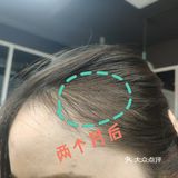 太好用了 谁说生发难的？站出来！ 