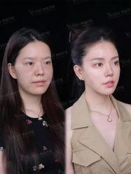 点击看大图 -Yestar艺星整形美容医院