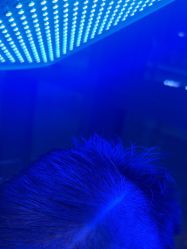 -碧莲盛·不剃发植发