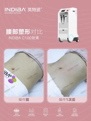 -半岛故事·法儿曼抗衰·indiba中心