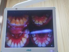 -爱牙联合口腔(门诊报销 海云庵店)
