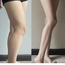 -Lily纤美·科技减脂中心