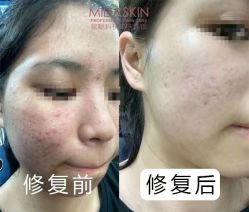 -MIDA蜜哒•科技逆龄美肤连锁