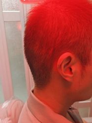 -碧莲盛·脱发养发中心