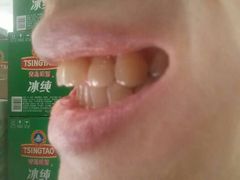 android_upload_pic-岳辰齿科(浦东长泰店)