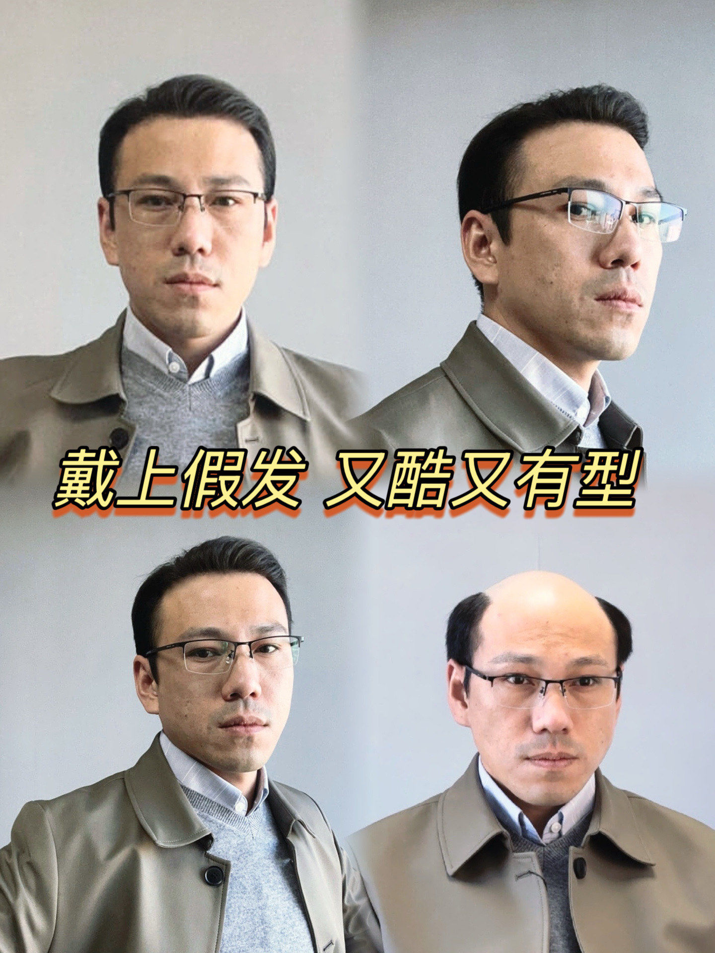 "地中海"大叔爆改型男の㊙️大公开:原来是假发