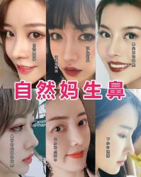 -北京米扬丽格医疗美容·联合丽格鼻整形中心