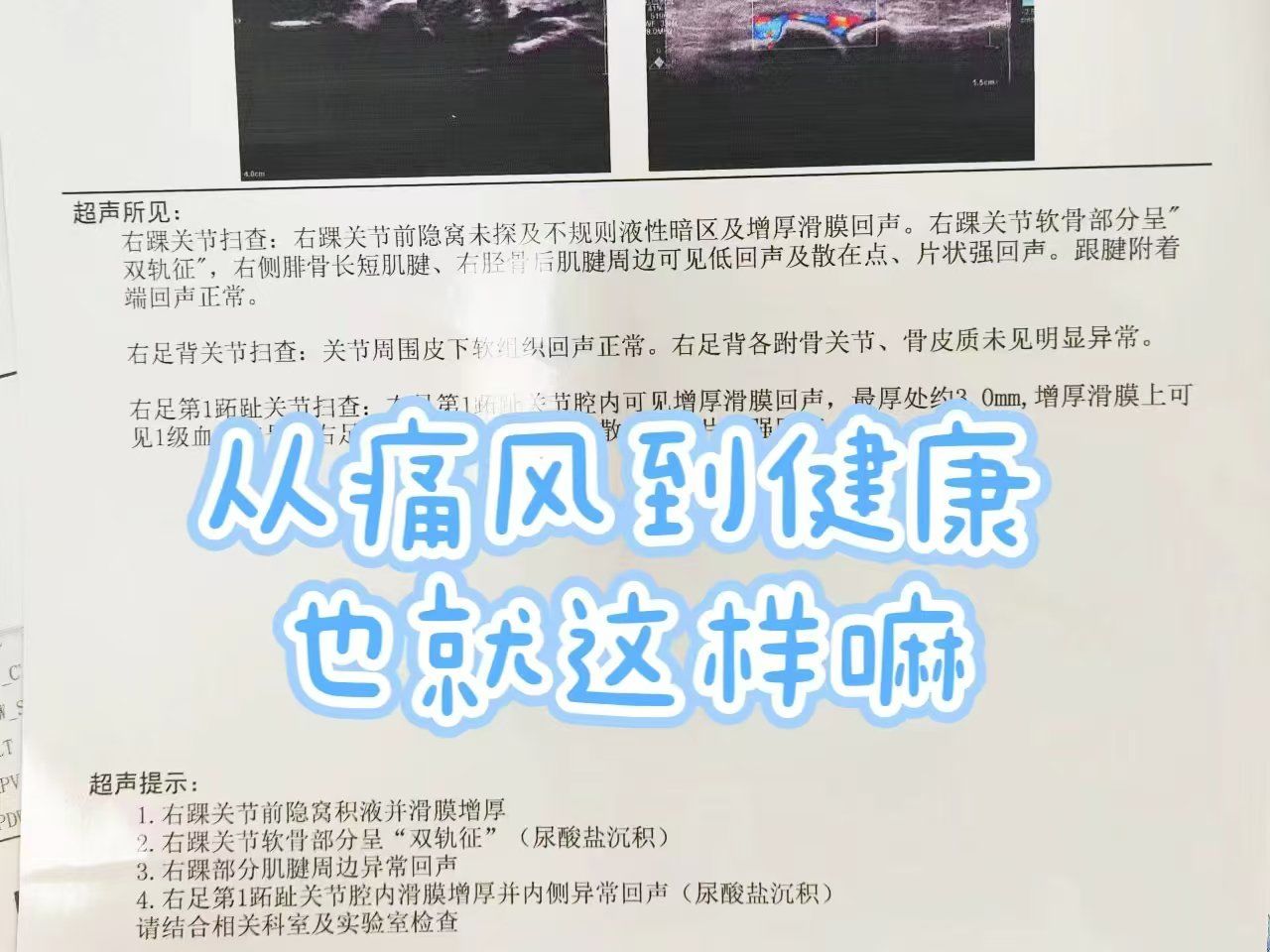 从痛风到健康人生,没想到痛风也就这样嘛!