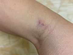 -上海市第八人民医院-体检中心