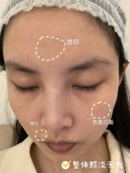 点击看大图 -成都艾特他整形外科医院