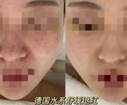 -春田皮肤管理中心品牌旗舰店
